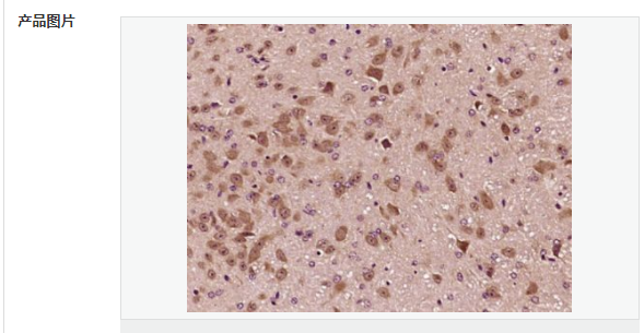 6077d9eda7e72.png image.png